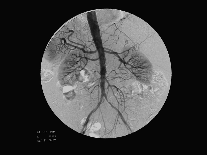 Cardiovascular-interventional image / Image © ASRT