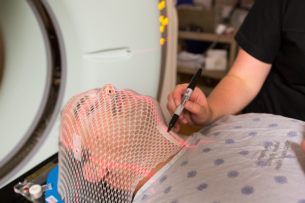 Patient wearing an immobilization mask