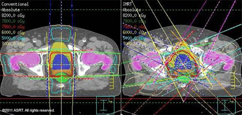 Radiation Therapy / Image © ASRT